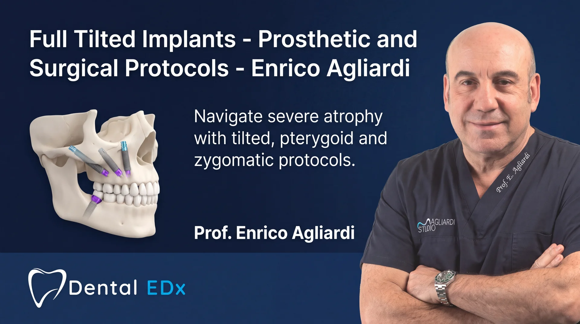 Full Tilted Implants — Prosthetic and Surgical Protocols course cover